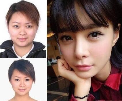 沈夢(mèng)辰,個(gè)人,資料,整容,前后,對(duì)比