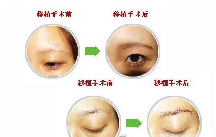 種植眉毛果圖片