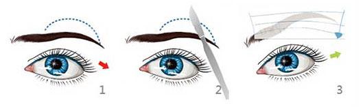 切眉手術(shù)前后對比照片