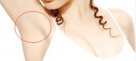 廣州,微創(chuàng),去除腋臭,多少錢