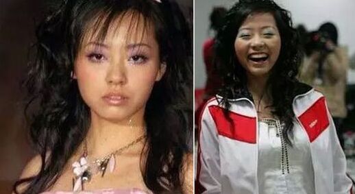 張靚穎整容了嗎 張靚穎整容前后照片對比