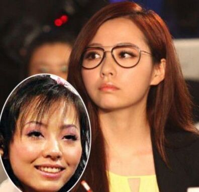 張靚穎整容了嗎 張靚穎整容前后照片對比