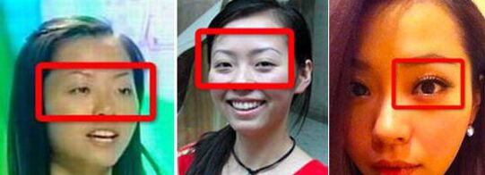 張靚穎整容了嗎 張靚穎整容前后照片對比