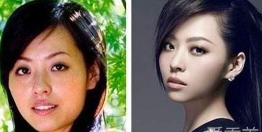 張靚穎整容了嗎 張靚穎整容前后照片對比