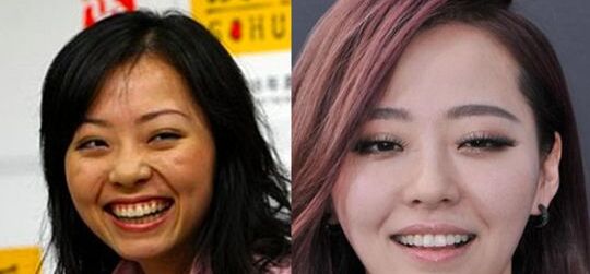 張靚穎整容了嗎 張靚穎整容前后照片對比