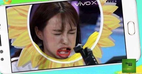 沈夢辰整容對比圖 下巴塞的假體被發(fā)現(xiàn) 