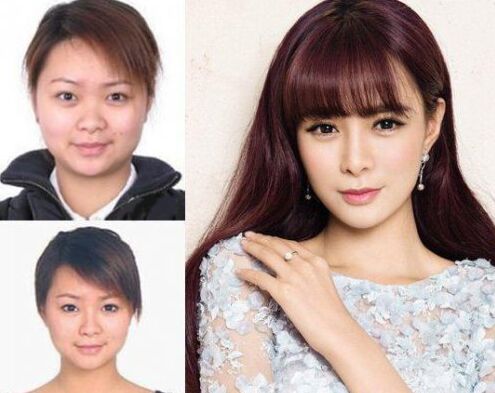 沈夢辰整容對比圖 下巴塞的假體被發(fā)現(xiàn) 