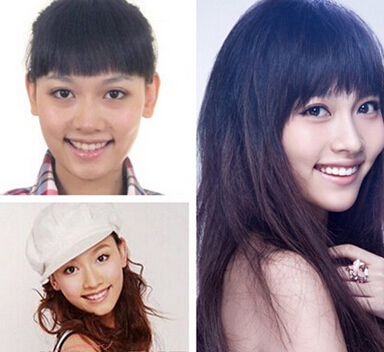白富美孫驍驍整容前竟是土肥圓 孫驍驍整容對比圖