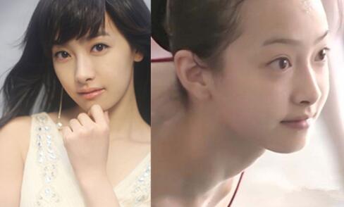 宋茜整容前后對比照 宋茜有沒有整容