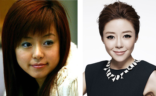 超女冠.軍安又琪變成了整容怪? 安又琪整容對比圖