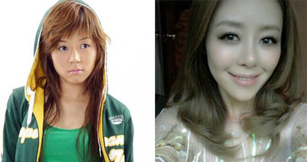 超女冠.軍安又琪變成了整容怪? 安又琪整容對比圖