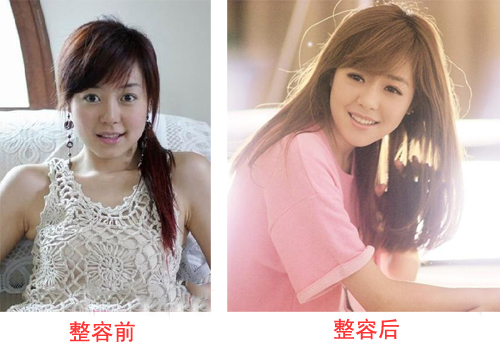 超女冠.軍安又琪變成了整容怪? 安又琪整容對比圖