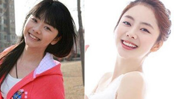 娃娃臉譚松韻整容了嗎 譚松韻整容對比圖