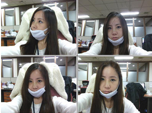 為大家分享我在北京301醫(yī)院做下頜角整形的真實歷程