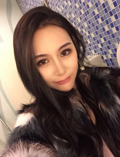 成都天使之翼做隆鼻整形改變了我的塌鼻子 果真的很不錯