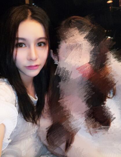 成都天使之翼做隆鼻整形改變了我的塌鼻子 果真的很不錯