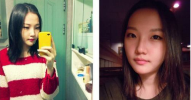 和大家分享北京301醫(yī)院做的下頜角整形真實經(jīng)