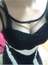 假體隆胸讓我告別小平胸 感謝北京彤美