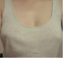 假體隆胸讓我告別小平胸 感謝北京彤美