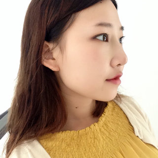 耳軟骨隆鼻改變了我的塌鼻梁 北京彤美做的果很棒