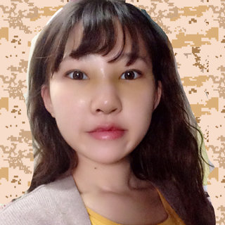 耳軟骨隆鼻改變了我的塌鼻梁 北京彤美做的果很棒