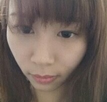 顴骨整形后我也變得甜美了