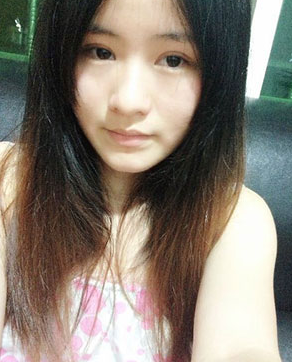 全切雙眼皮十天啦~來看看我的果