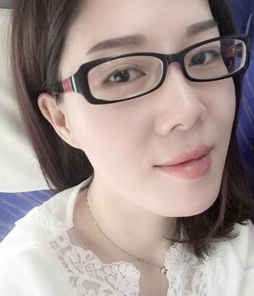 雙眼皮恢復記錄 果很滿意~