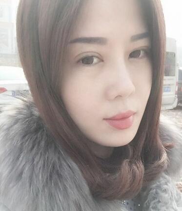 雙眼皮恢復記錄 果很滿意~