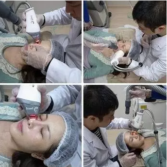 成都玉之光激光嫩膚經(jīng)歷 愛美的MM一定要看