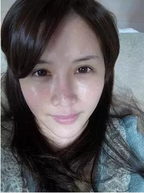 成都玉之光激光嫩膚經(jīng)歷 愛美的MM一定要看