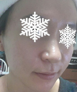 北京禾美嘉彩光嫩膚 果不錯(cuò)哦~