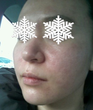 北京禾美嘉彩光嫩膚 果不錯(cuò)哦~