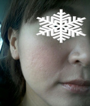 北京禾美嘉彩光嫩膚 果不錯(cuò)哦~