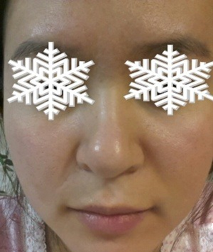 北京禾美嘉彩光嫩膚 果不錯(cuò)哦~