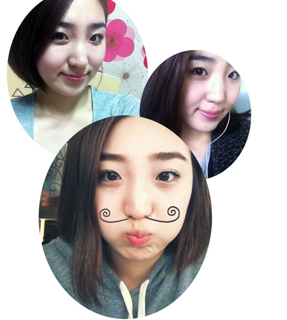 深圳希思崔院長(zhǎng)隆鼻整形 擺脫了豬妹妹的稱號(hào)