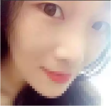 深圳希思做的雙眼皮 現(xiàn)在美美的