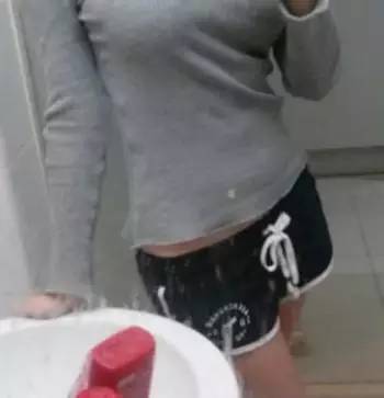 北京炫美腹部吸脂術(shù)后 穿衣服更有型了!