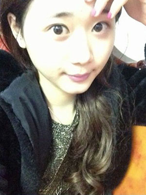 北京常好麗格割雙眼皮一周啦~