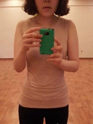 北京常好麗格腰腹吸脂后20天的感受 恢復日記來咯~