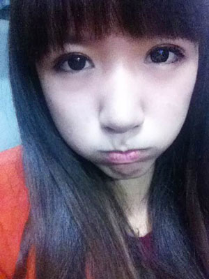 北北京常好麗格三點(diǎn)定位雙眼皮恢復(fù)一個(gè)月經(jīng)歷