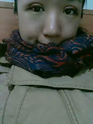 北北京常好麗格三點(diǎn)定位雙眼皮恢復(fù)一個(gè)月經(jīng)歷