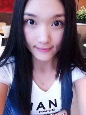 北京常好麗格做假體隆鼻3個(gè)月