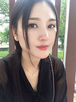 北京常好麗格做假體隆鼻3個(gè)月