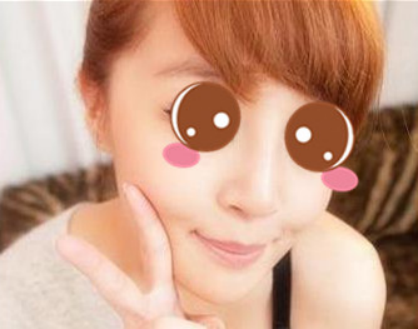 膨體隆鼻讓我的顏值更上一層