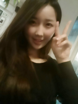 北京清木自體脂肪豐面頰2個月果分享