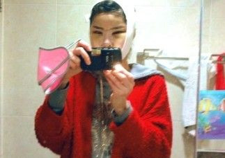 做了磨顴骨手術(shù)的我從小鴨子變成白天鵝 謝謝柳大烈教授