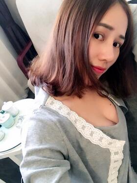 蜀尚蓉雅自體脂肪豐胸2個月啦~