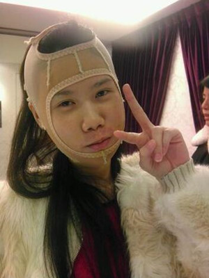 磨了下頜角和顴骨的我 變成小仙女了