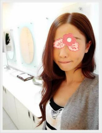 埋埋蛋白線.提升拯救了我的大小臉和皮膚下垂